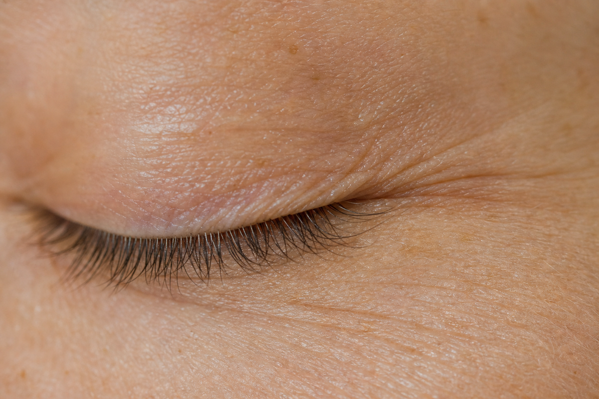 Contorno occhi con rughe d'espressione: dove agiscono i peptidi biotecnologici