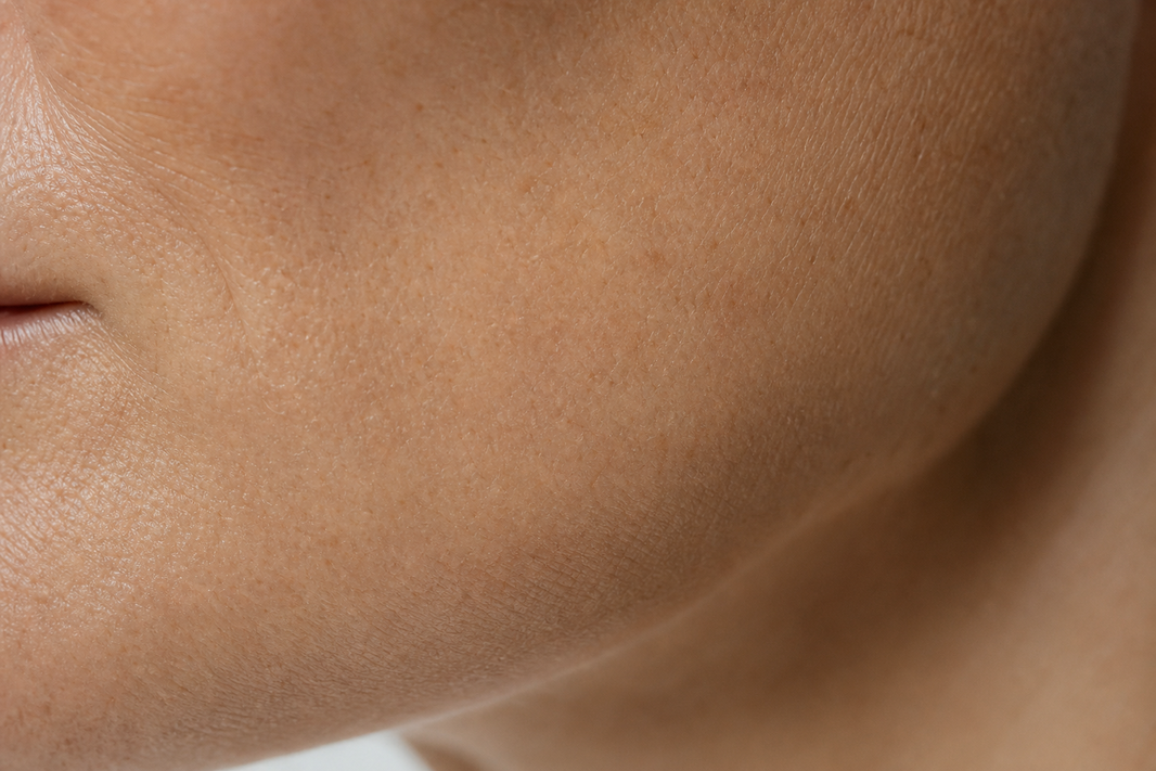 Pelle del viso in macro: come agisce il PDRN su texture e compattezza